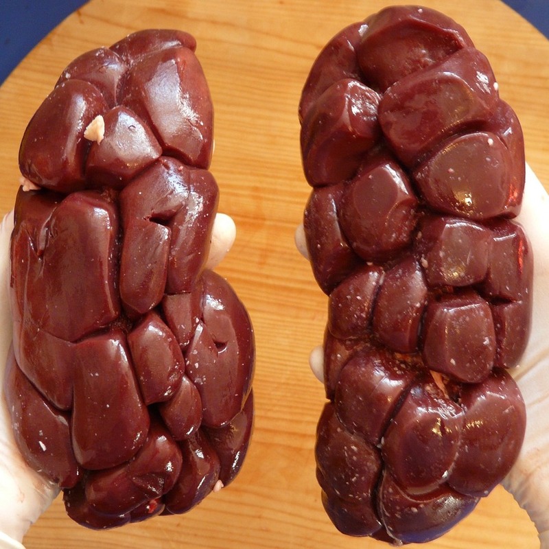 kidney